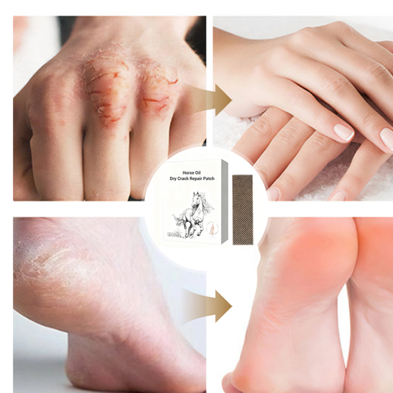 ⏰ Horse Oil Hand & Feet Repair Patch |  Intensive Hydration for Dry Cracked Skin, Long-Lasting Relief | Perfect Winter Care Gift Set ✨