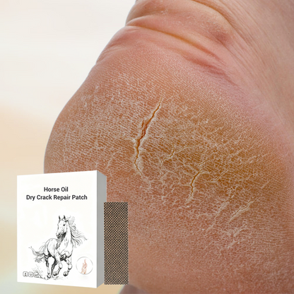⏰ Horse Oil Hand & Feet Repair Patch |  Intensive Hydration for Dry Cracked Skin, Long-Lasting Relief | Perfect Winter Care Gift Set ✨